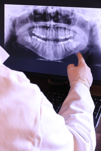 Best Emergency Dentist for Knocked-Out Tooth in Deadwood, SD