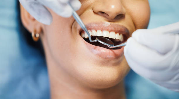 Best Emergency Dental Services for Seniors in Deadwood, SD